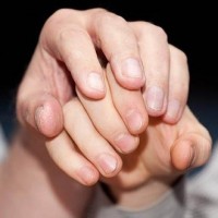 Дом слепоглухих: создать альтернативу убийственной схеме